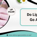 Do Lip Fillers Go Away? Everything You Need to Know