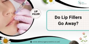Do Lip Fillers Go Away?