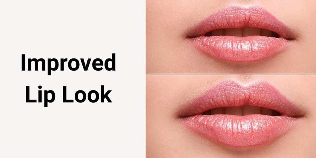 Improved Lip Look
