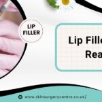Lip Filler Allergic Reactions Explained: Causes, Symptoms and Treatment