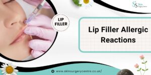Lip Filler Allergic Reactions