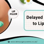 Delayed Reactions to Lip Fillers: What You Need to Know?