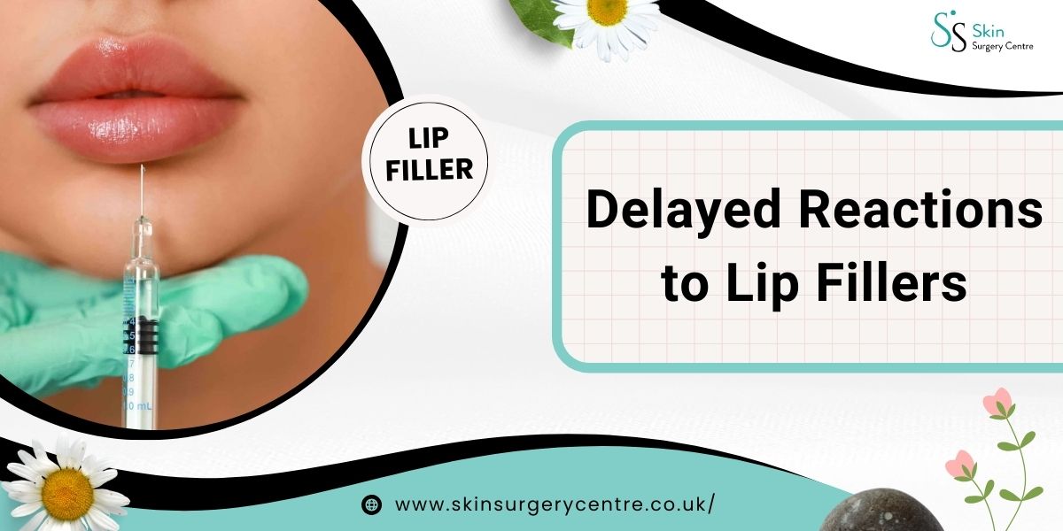 Delayed Reactions to Lip Fillers