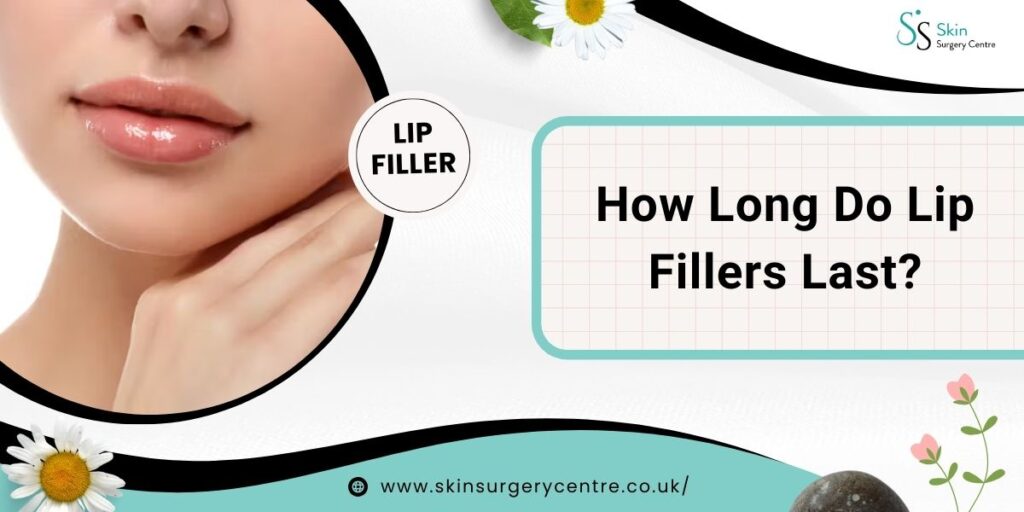 How Long Do Lip Fillers Last? A Comprehensive Overview