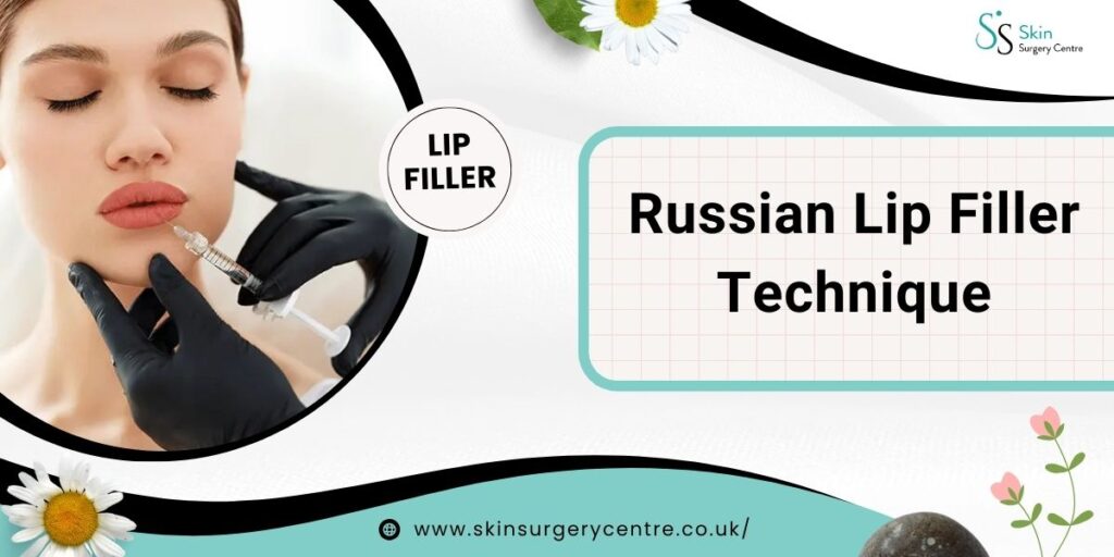 Russian Lip Filler Technique: Sculpted, Elegant Lips with a Modern Aesthetic