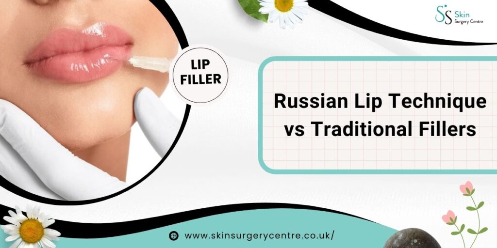Russian Lip Technique vs Traditional Fillers: Which is Right for YOU?