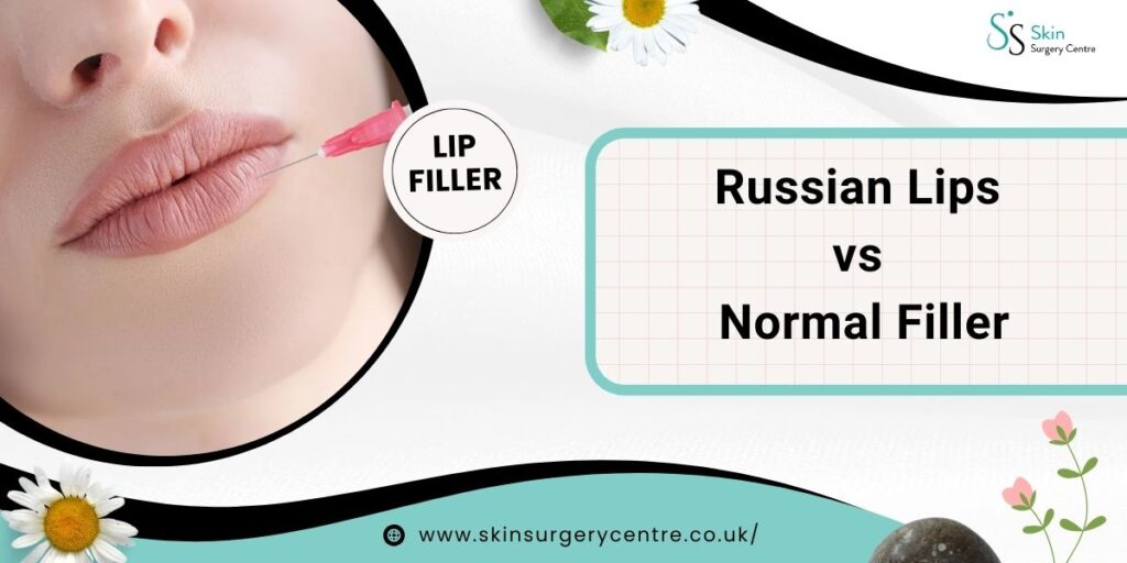 Russian Lips vs Normal Filler: Which Lip Filler Technique is Right for You?