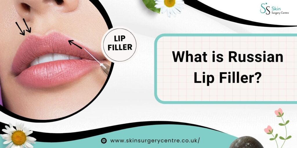 What is Russian Lip Filler? Everything You Need to Know