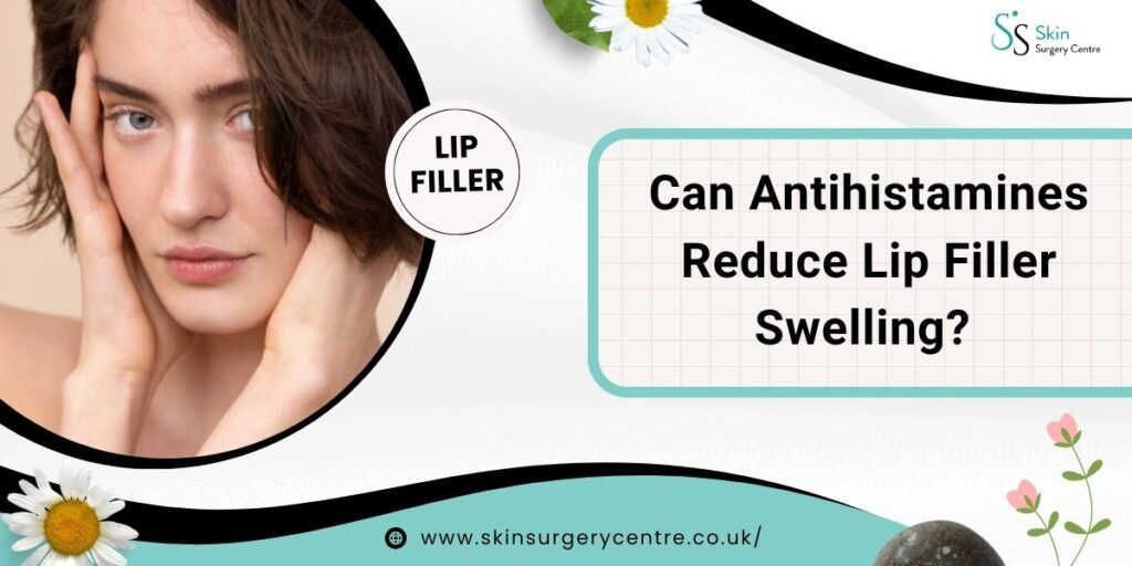 Can Antihistamines Reduce Lip Filler Swelling?