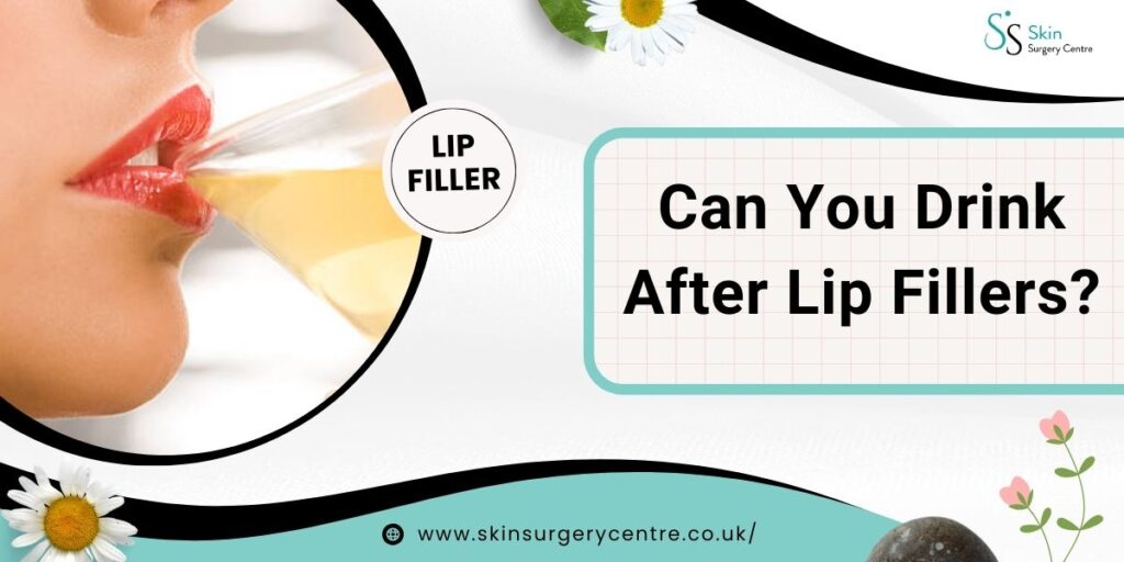 Can You Drink After Lip Fillers? UK Guide