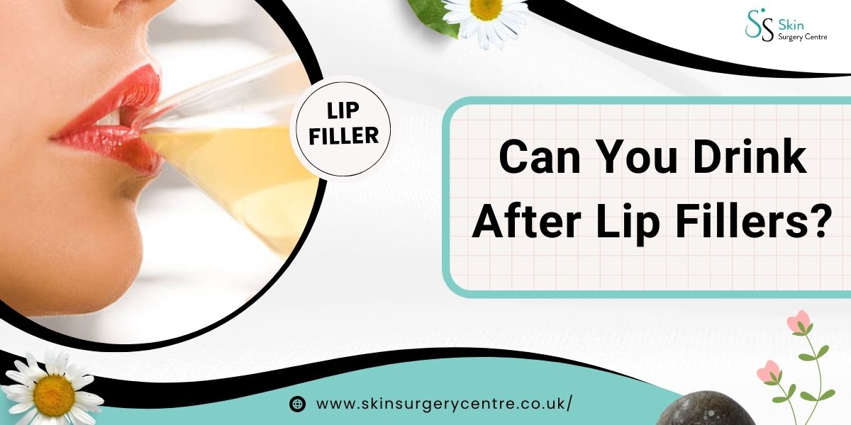Can You Drink After Lip Fillers?