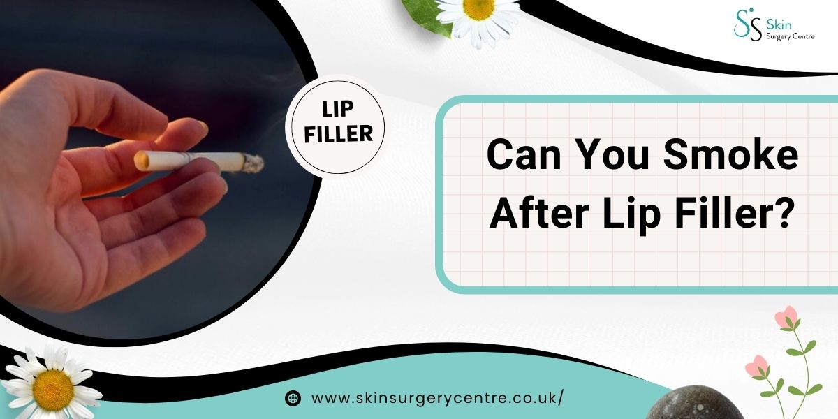 Can You Smoke After Lip Filler