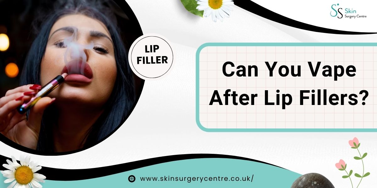 Can You Vape After Lip Fillers?