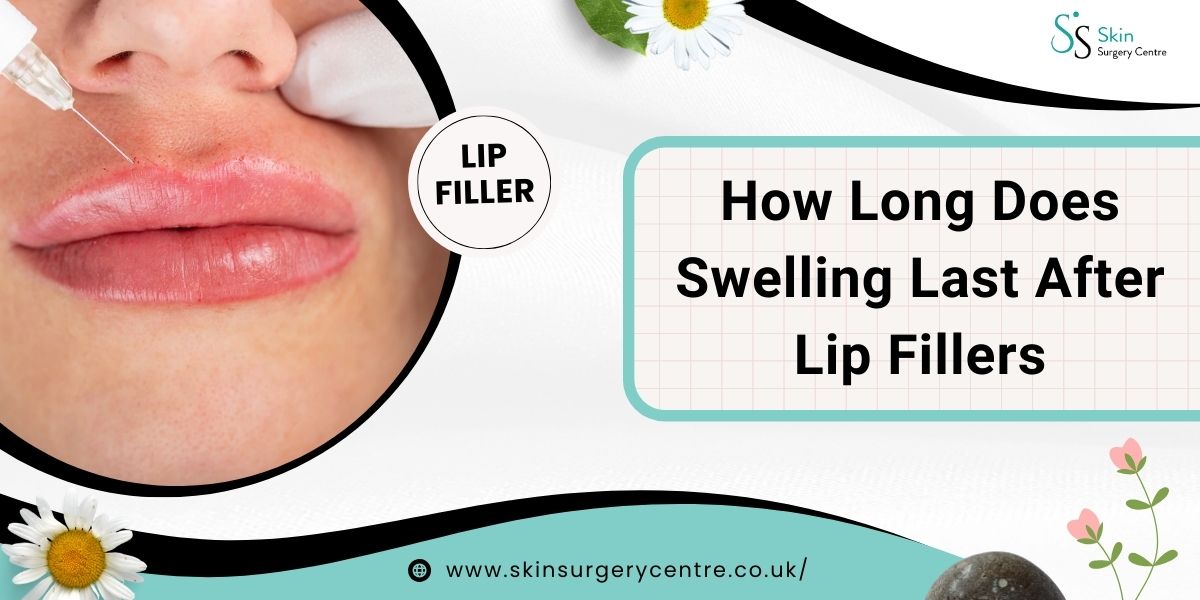 How Long Does Swelling Last After Lip Fillers