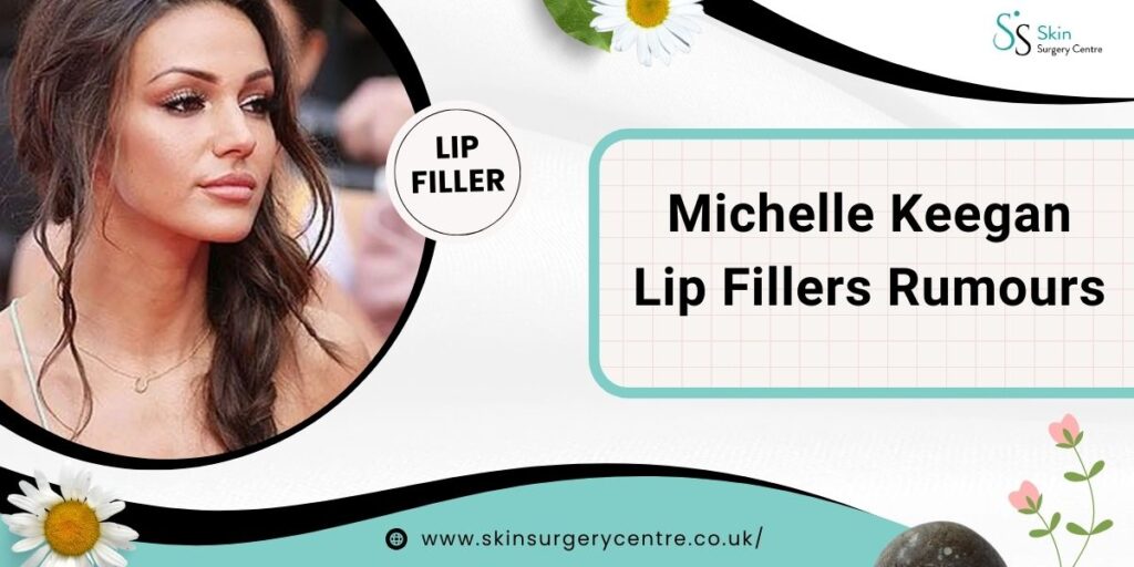 Michelle Keegan Lip Fillers Rumours & Cosmetic Trends UK