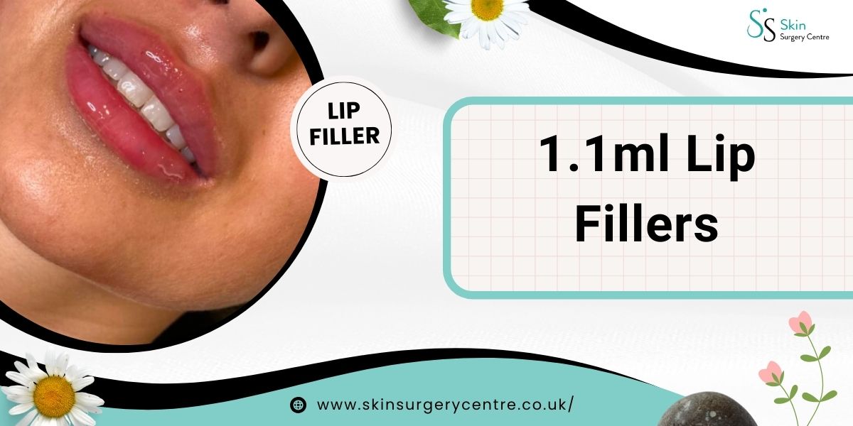 1.1ml Lip Fillers