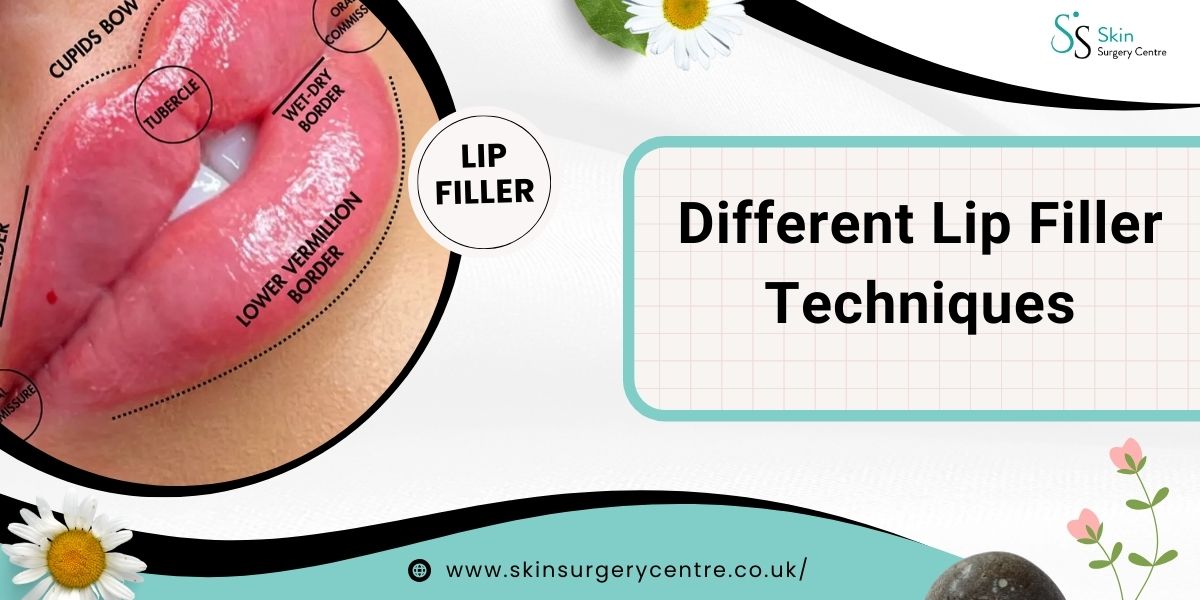 Different Lip Filler Techniques