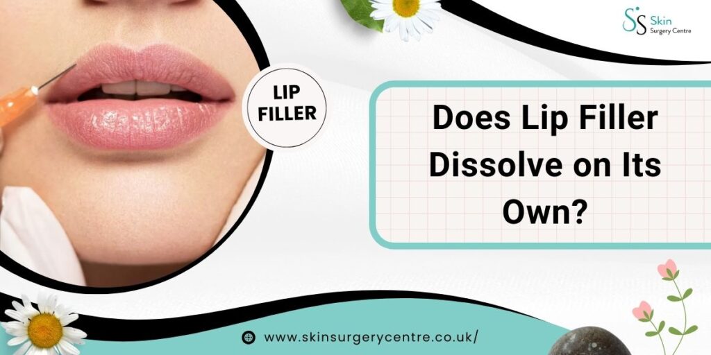 Does Lip Filler Dissolve on Its Own? Timeline, Factors & Expert Advice