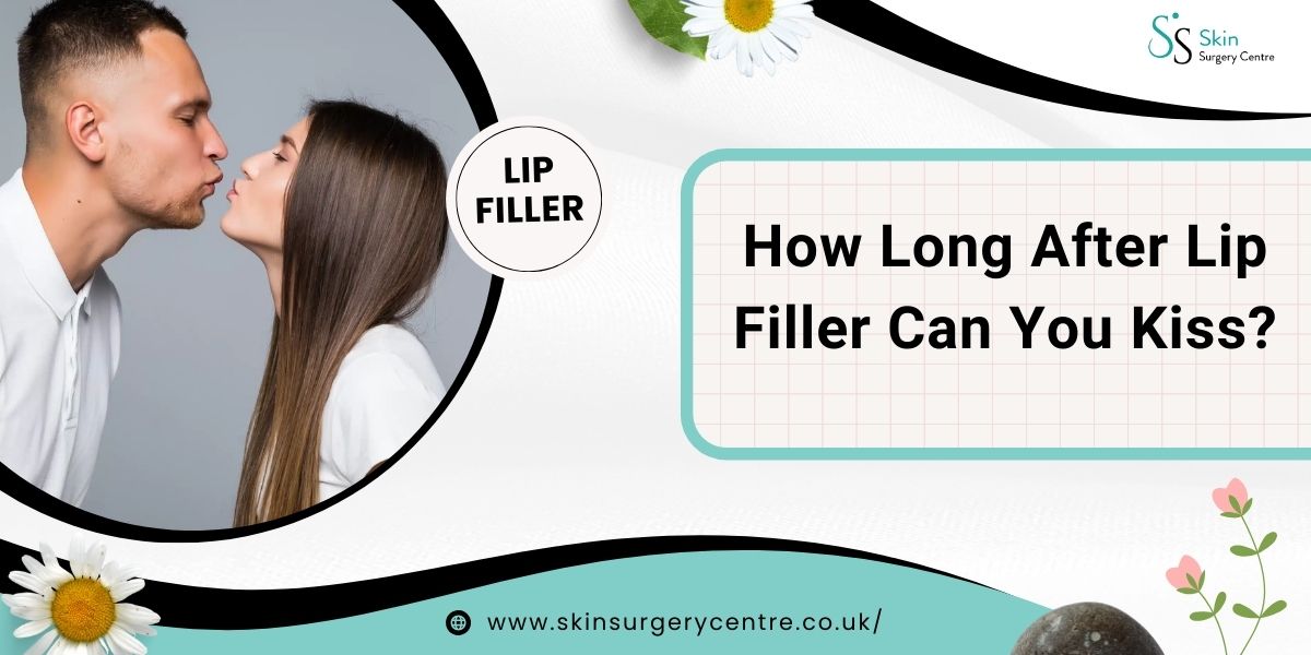 How Long After Lip Filler Can You Kiss