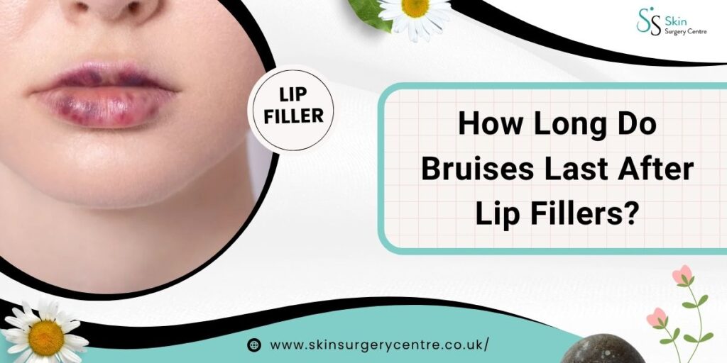 How Long Do Bruises Last After Lip Fillers? Let’s Read the Complete Guide