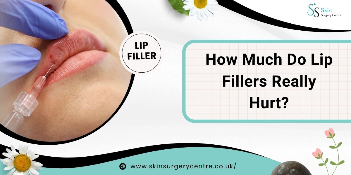 How Much Do Lip Fillers Really Hurt