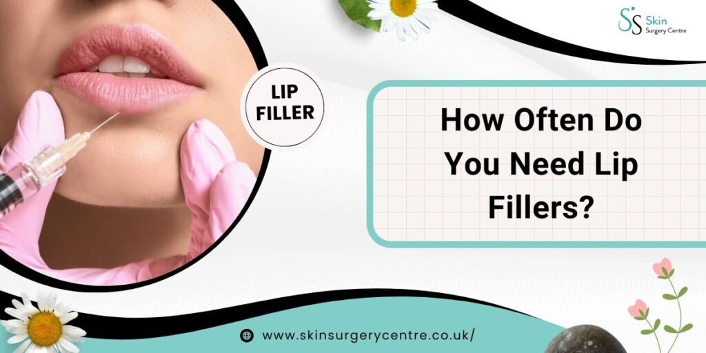 How Often Do You Need Lip Fillers?
