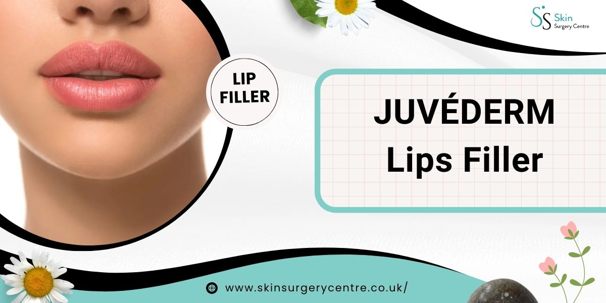 JUVÉDERM Lips Filler