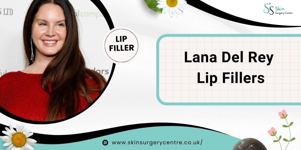 Lana Del Rey Lip Fillers