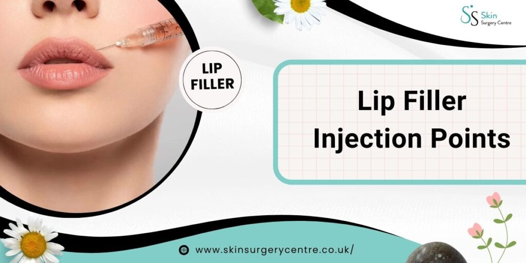 Lip Filler Injection Points: Personal Guide to Augmented, Natural-Seeming Lips