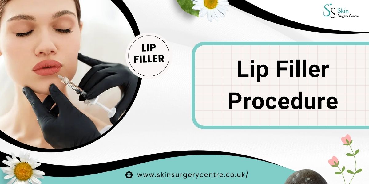 Lip Filler Procedure