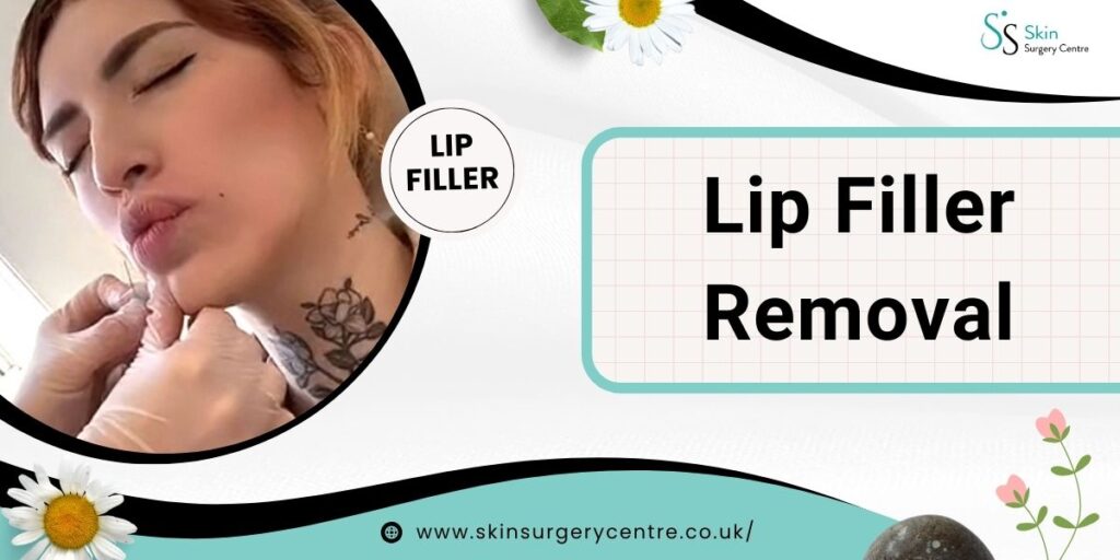 All You Need To Know Before Lip Filler Removal