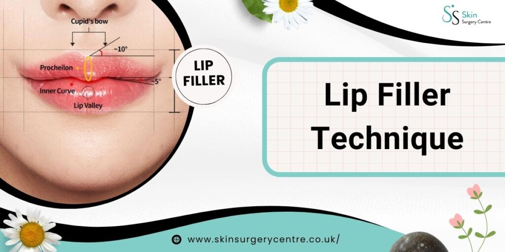 A Complete Guide to Lip Filler Techniques: Where Art Meets Beauty