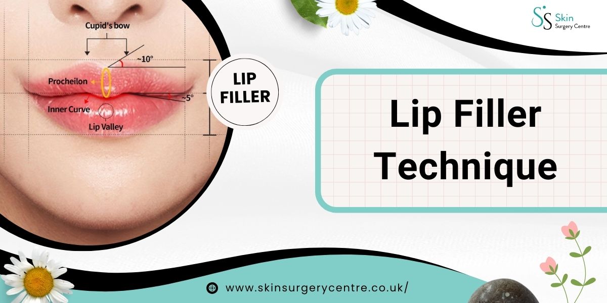 Lip Filler Technique