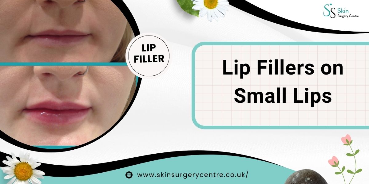 Lip Fillers on Small Lips