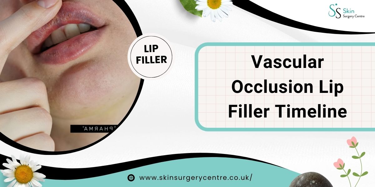 Vascular Occlusion Lip Filler Timeline