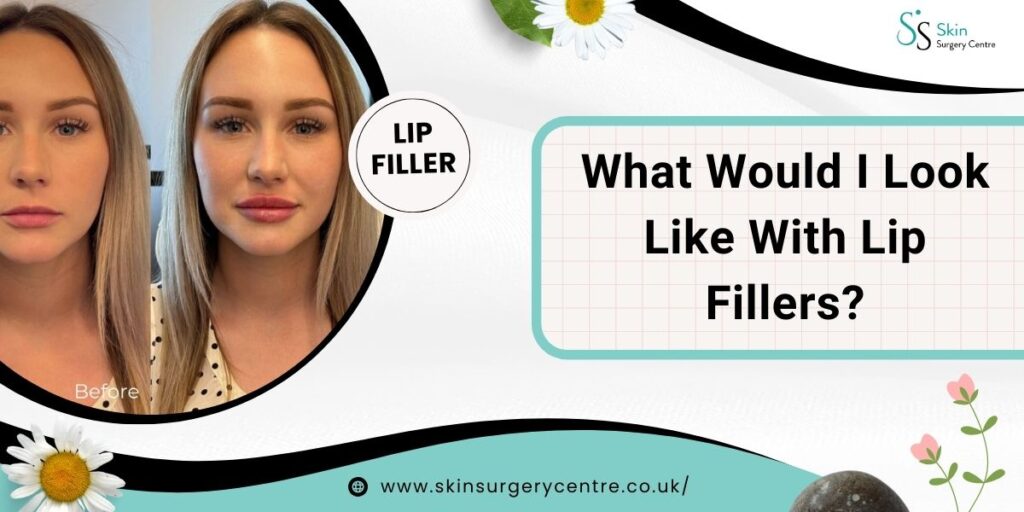 What Would I Look Like With Lip Fillers? Facial Changes Explained