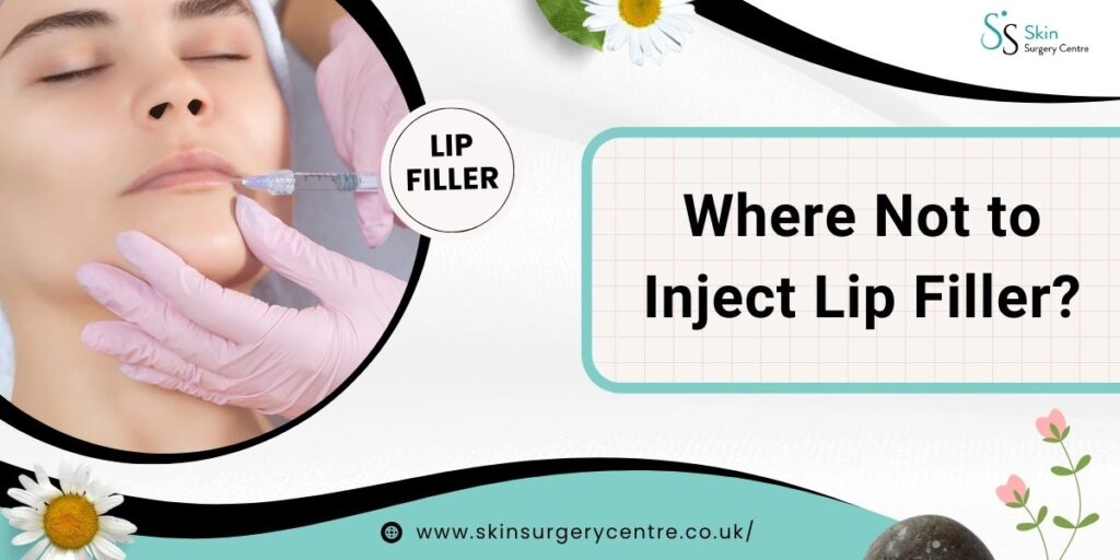 Where Not to Inject Lip Filler: Important Areas to Avoid