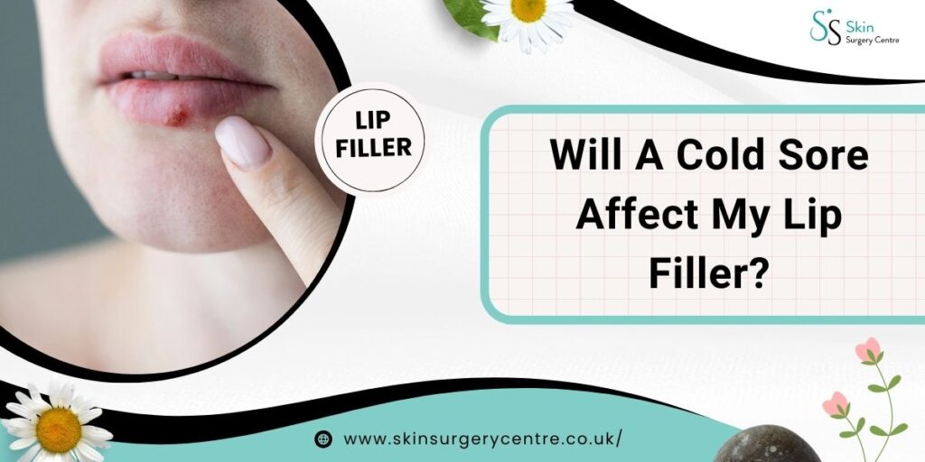 Will A Cold Sore Affect My Lip Filler?